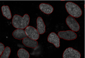 Mask R-CNN for Image Segmentation - Analytics Vidya