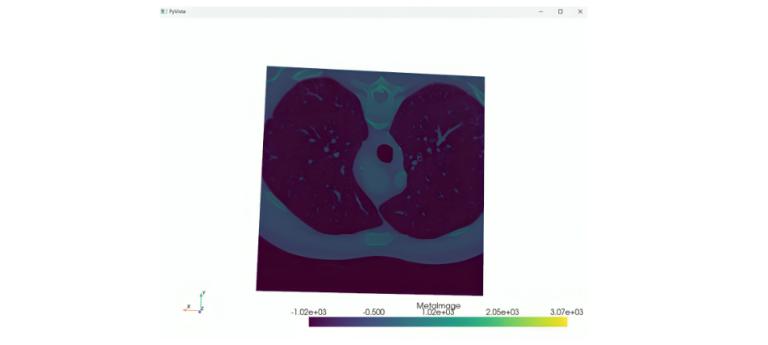 Pyvista Library How to Use PyVista for Interactive 3D Medical Visualizations