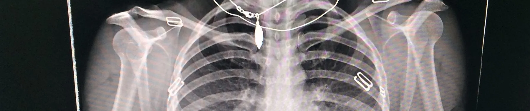 21 Computer Vision Projects from Beginner to Advanced (2026 Guide)